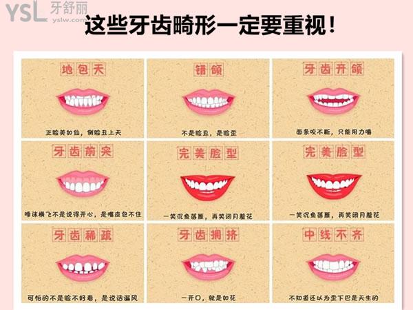 牙齿畸形的几种情况