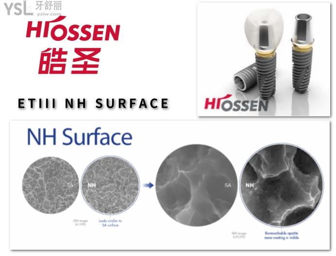 美国hiossen皓圣种植体