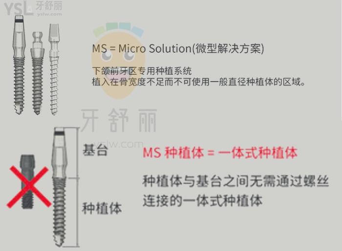 种植体公司都很重视稳定性和骨结合度等,技术不断研发也是在这些方面