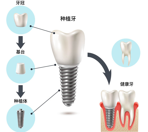 固原黄钱口腔诊所