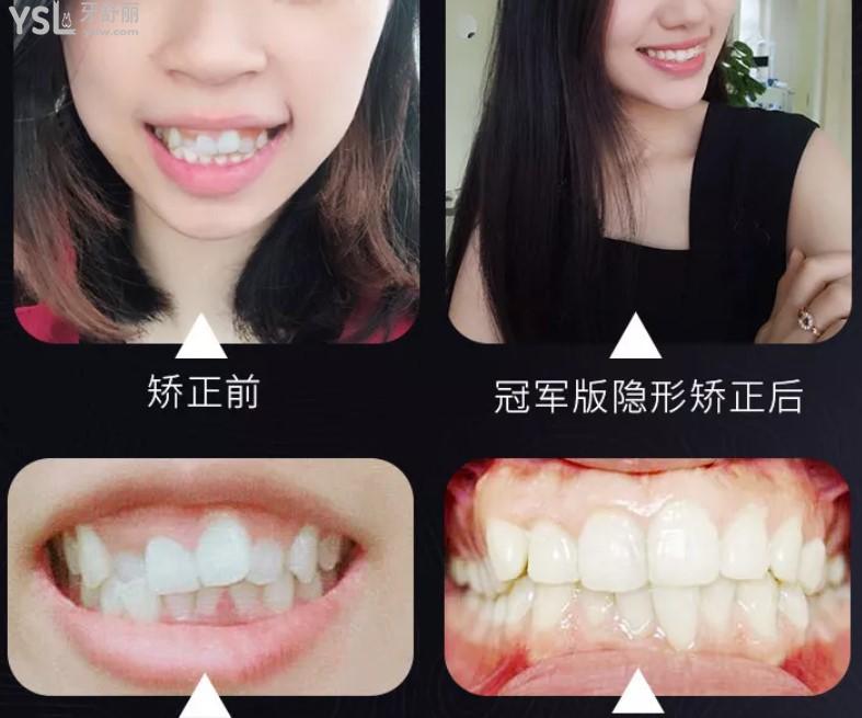 {F1F68EE7-80B9-4A0B-B<span style=