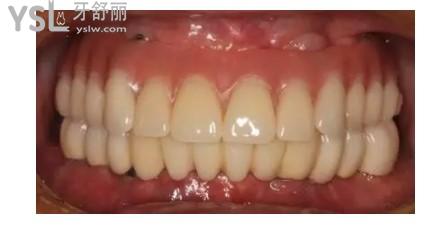 {F6BB6AE3-<span style=