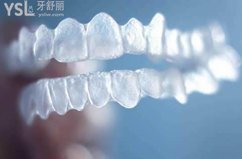 隐适美隐形矫正有年龄限制吗？