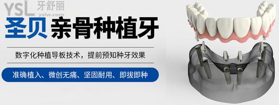 广州圣贝牙科种植牙