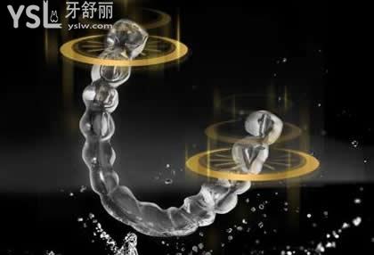 隐适美和时代天使隐形矫正如何选择？