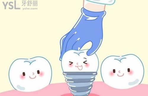 美国ZIMMER种植体优势：
