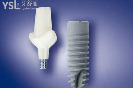 种植牙的种类：