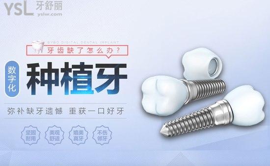 北京维乐口腔数字化种植牙