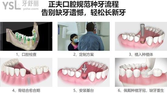 深圳正夫口腔种植牙