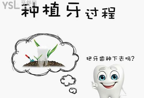 种植牙应该如何选择种植体？