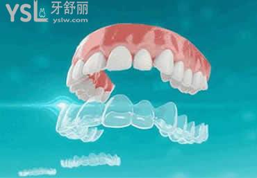 时代天使COMFOS：