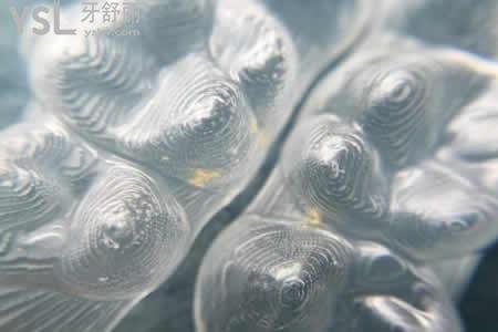 COMFOS和时代天使隐形矫正有啥区别？