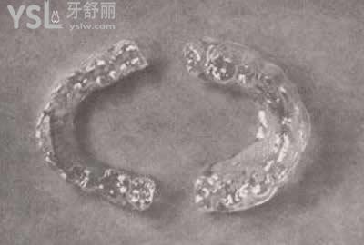 正雅隐形矫正的费用：