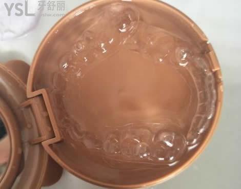隐形牙套和传统牙套的区别：