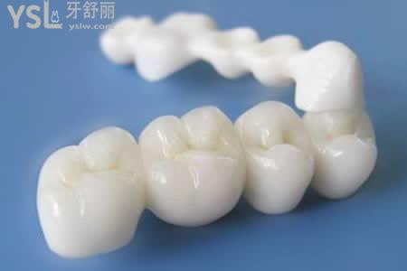 全瓷牙的优越性能表现在哪几方面？