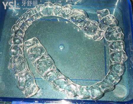 时代天使隐形矫正的优势：