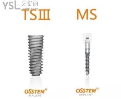 韩国奥齿泰（OSSTEM）种植体