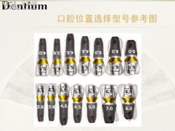 韩国登腾种植牙
