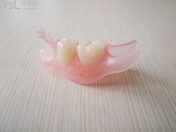一颗门牙活动义齿图片图片