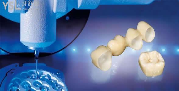 德国迪瑞全瓷牙 德国迪瑞全瓷牙