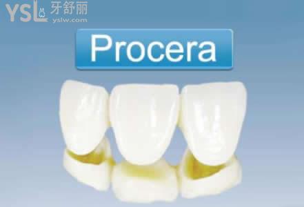 瑞典全瓷牙 瑞典全瓷牙