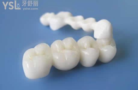韩国DMAX谛美克思全瓷牙 韩国DMAX谛美克思全瓷牙