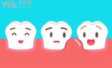 牙周炎导致牙龈萎缩怎么恢复