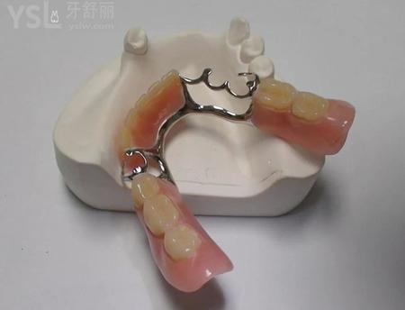 假牙
