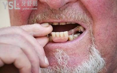 假牙1