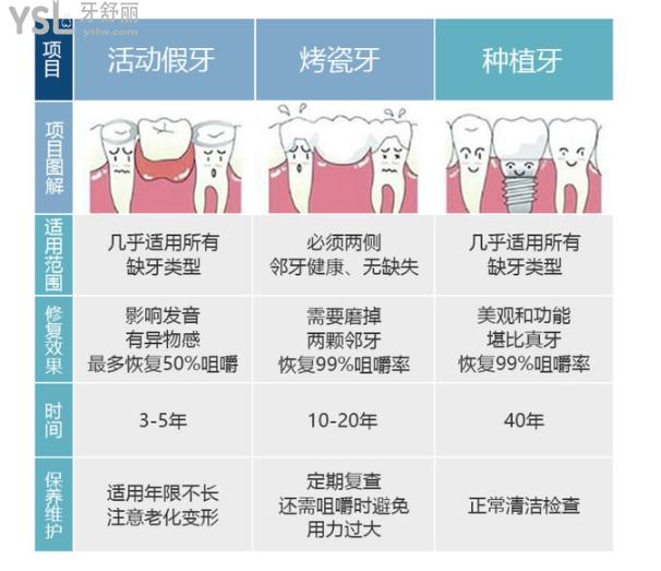 活动义齿价格表图片