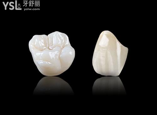1000元的全瓷牙和1500的区别大吗，3000元又如何？来看！