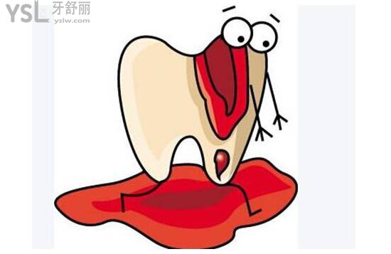 牙龈出血网络配图