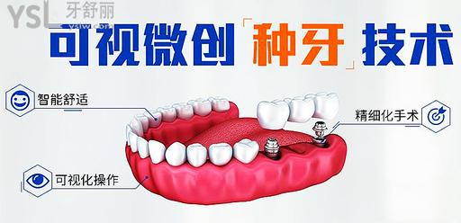 什么是数字化种植牙技术？