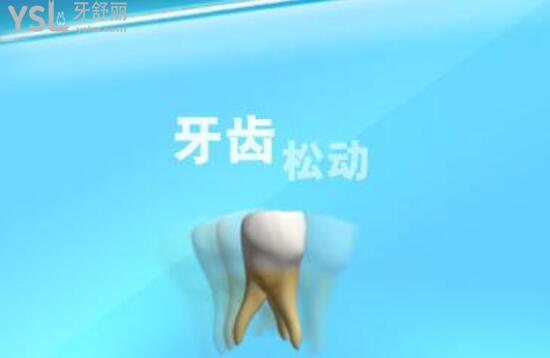 牙齿松动图片