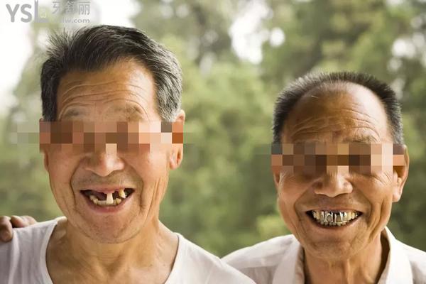 老年人牙掉了必须种植吗，老人牙齿掉了怎么处理好？快来学！