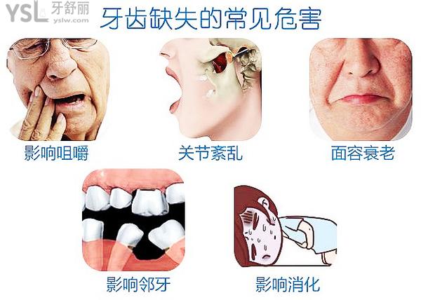 全口无牙怎么种植牙，来看答案