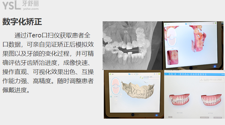 深圳牙科医院哪家好的医院价格还便宜