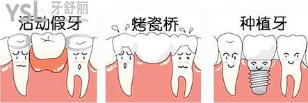 镶牙和种牙的区别在哪里