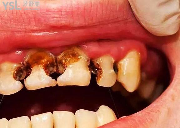 正确认识很重要