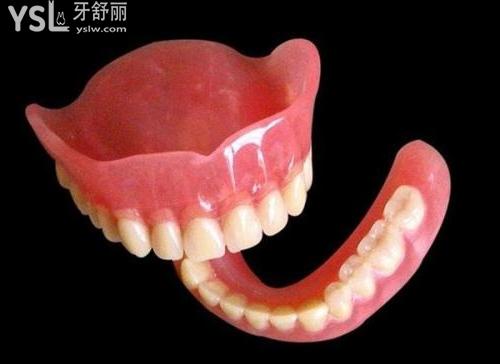 全口义齿种类
