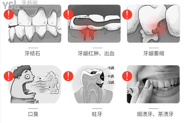 细菌对牙齿的危害