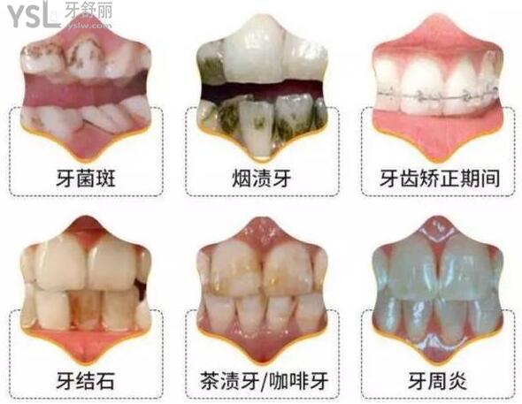 同步齿科为什么便宜 性价比这么高可以用**吗.jpg