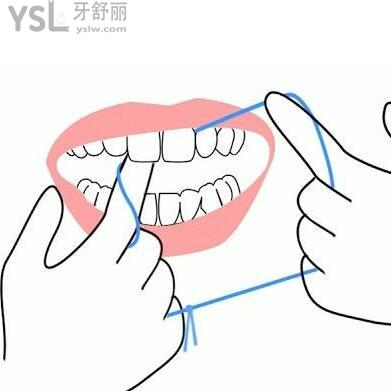 牙线