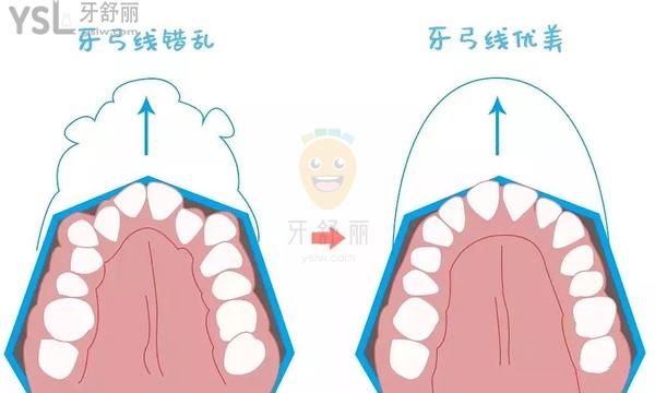 上海悦康齿科正规靠谱吗_地址_视频_口碑好不好_收费标准_能用吗