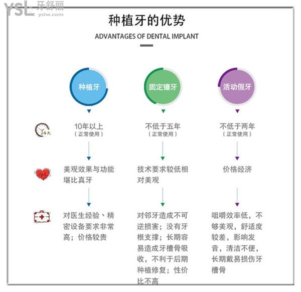 北京金圣口腔种植牙优势