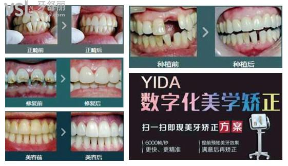 苏州看牙好的牙科医院排名