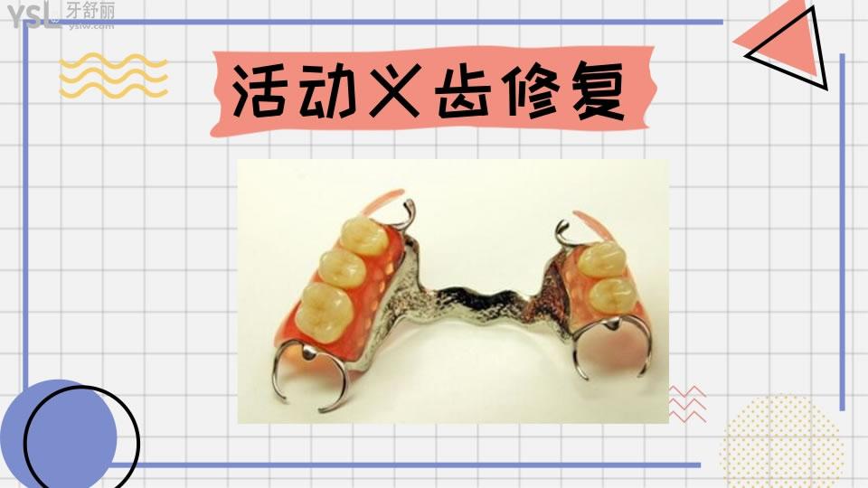 牙齿修复的几种方法和价格如何呢 .jpg