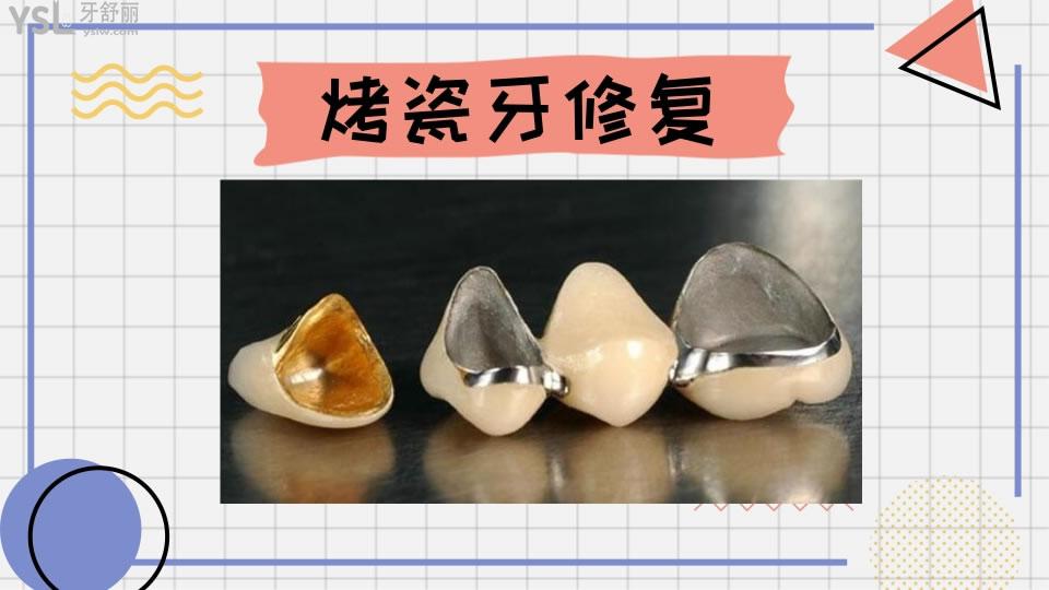 牙齿修复的几种方法和价格如何呢 .jpg
