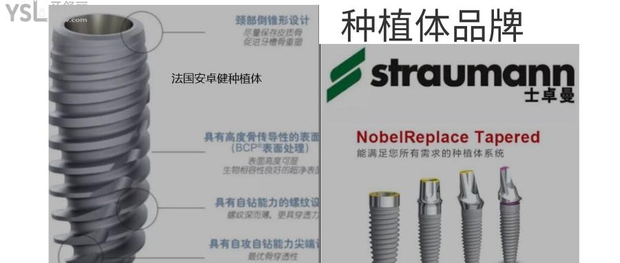 种植牙什么时候降价