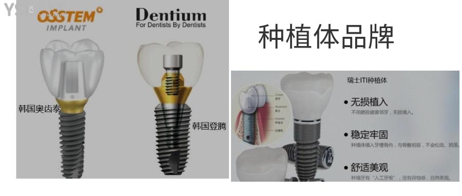 种植牙什么时候降价